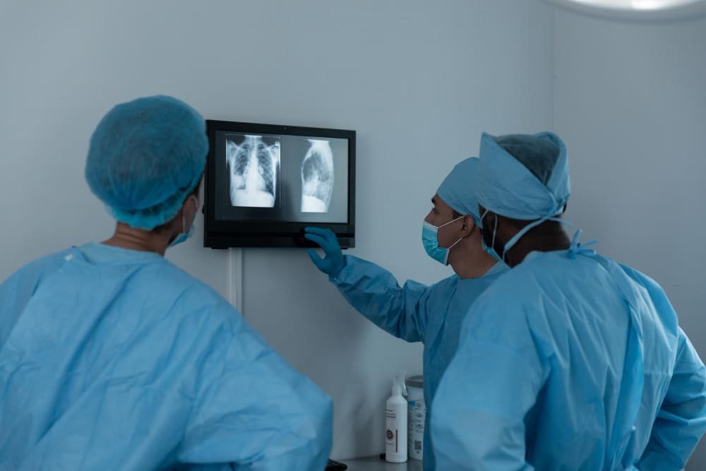 علاج أورام الرئة بالأشعة التداخلية