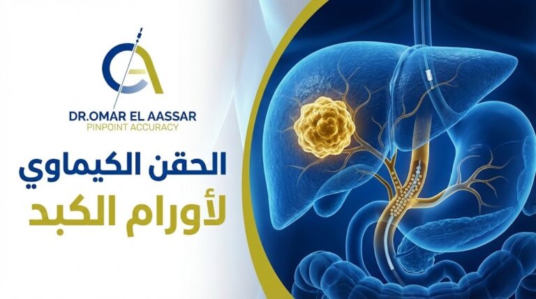 الحقن الكيماوي لاورام الكبد