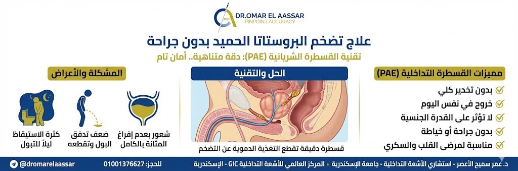 مميزات علاج تضخم البروستاتا بالقسطرة التداخلية