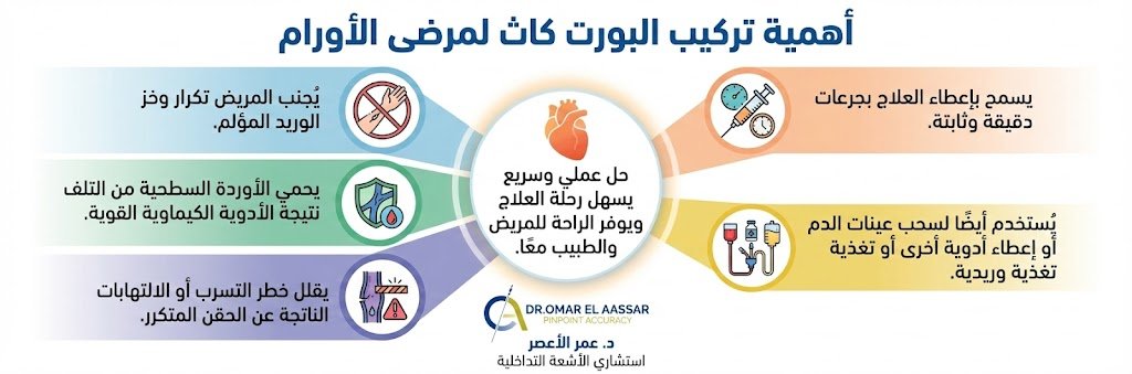 أهمية تركيب البورت كاث لمرضى الأورام