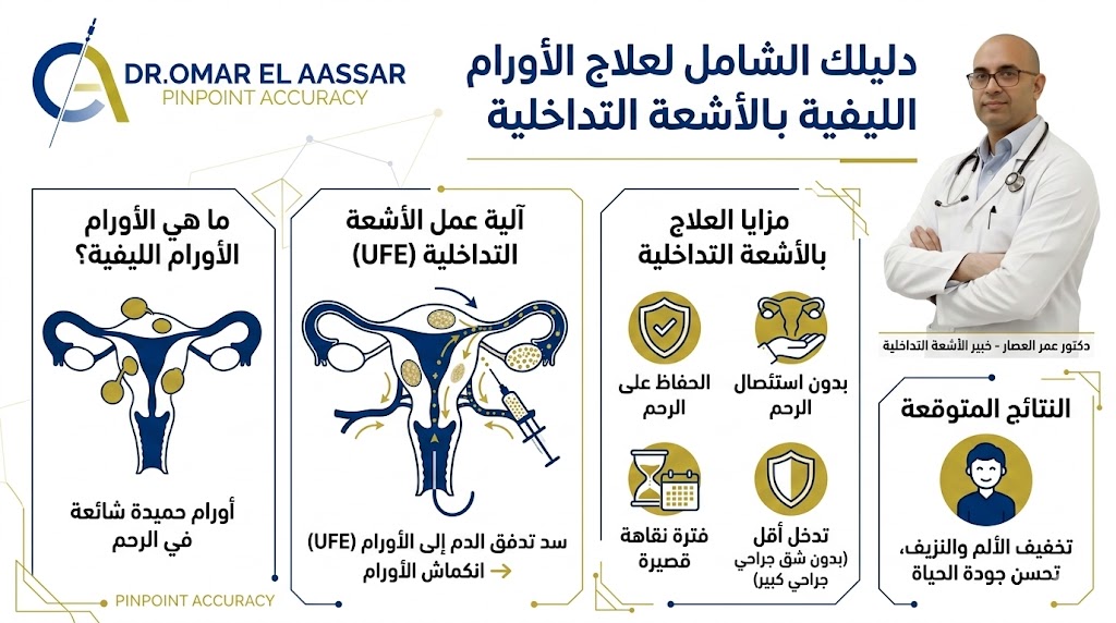 علاج الأورام الليفية بالأشعة التداخلية: الحل بدون جراحة 